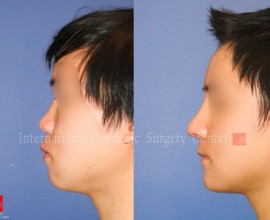 VIP Harmony face surgery