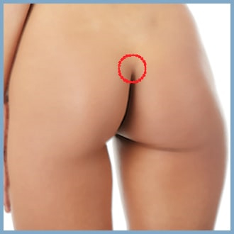 Steps for Brazilian Butt Lift Method