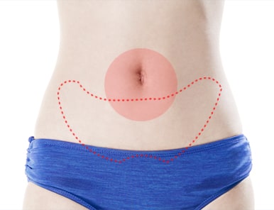 Liposuction and Tummy Tuck Combination