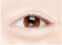 Steps for Lower Eyelid Surgery Method