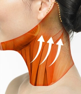 Necklift Surgery Method