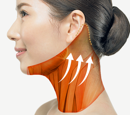 Non-Surgical Neck Wrinkle Removal Methods