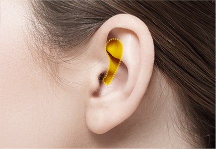 Ear Cartilage is used for covering the nasal tip area or complementing the insufficient amount of the septal cartilage.